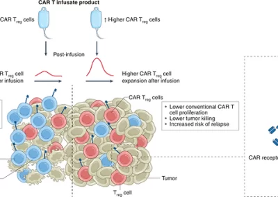 Células CAR TReg associadas à progressão da doença após o tratamento – Nem tudo são flores